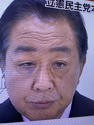 立憲民主党・野田佳彦代表の右目の下にアザがある画像